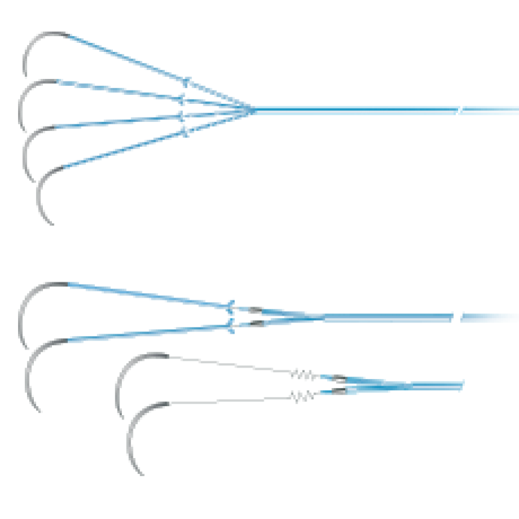 Quadripolar - PACING WIRES Quadripolar - PACING WIRES