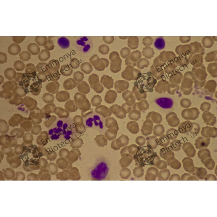 GIEMSA FOR Helocobacter Pylory 