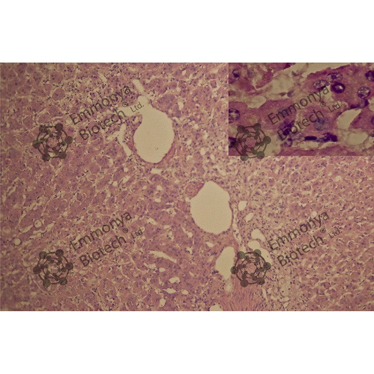 MAYER’S HAEMATOXYLIN