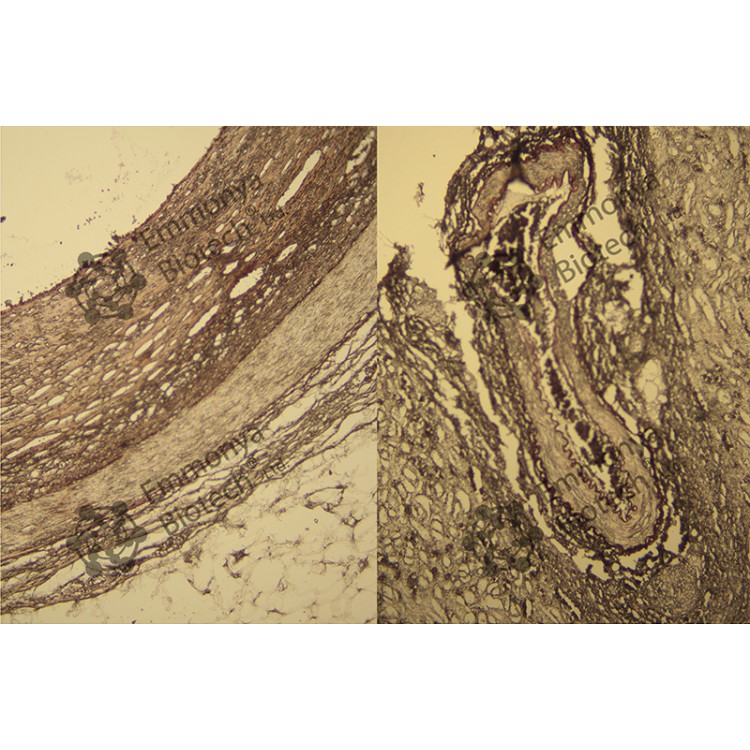ORCEIN FOR  ELASTIC FIBERS